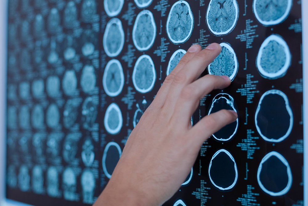 types of parkinsons disease