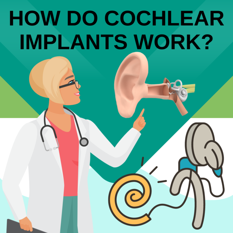 Cochlear Implants