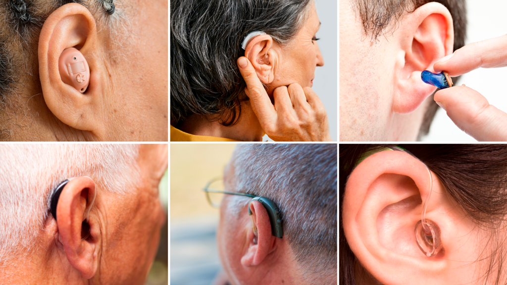 hearing aids for severe loss